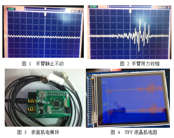 老人肌电采集和跌倒检测、动作识别（程序、设计报告等）_百工联_工业互联网技术服务平台