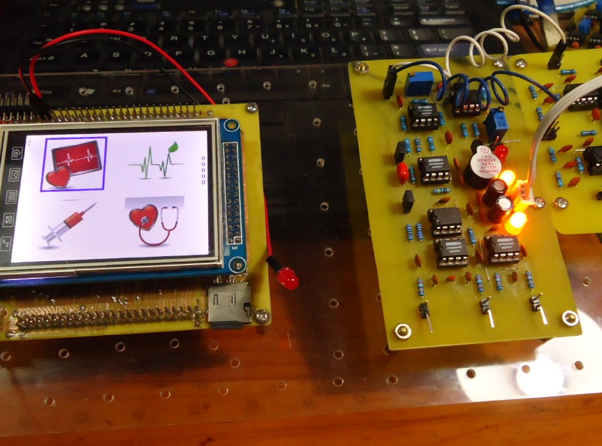 【私人开源项目】STM32为核心设计的人体心电采集系统软硬件（电路图和工程文件）_鹏程工联_工业互联网技术服务平台