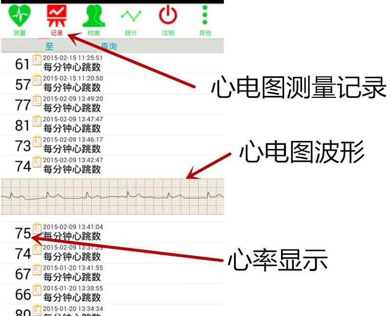 便携式心电图检测仪，手机云控制（客户端、二次开发说明文档+视频讲解）_百工联_工业互联网技术服务平台